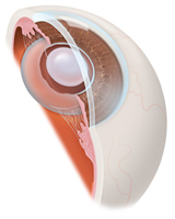 Cataract Surgery | Toric IOLs | YAG Capsulotomy | Brooklyn Heights